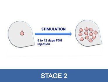 Donarea de ovule Stage 1
