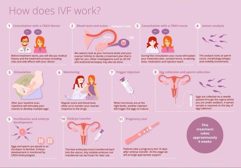 Step by step how In Vitro Fertility works