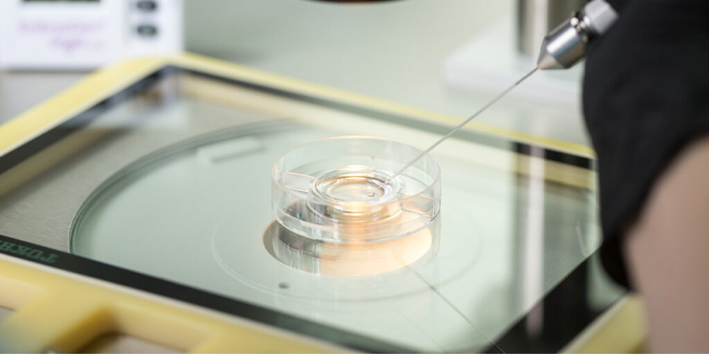 Ivf Gender Selection Cyprus