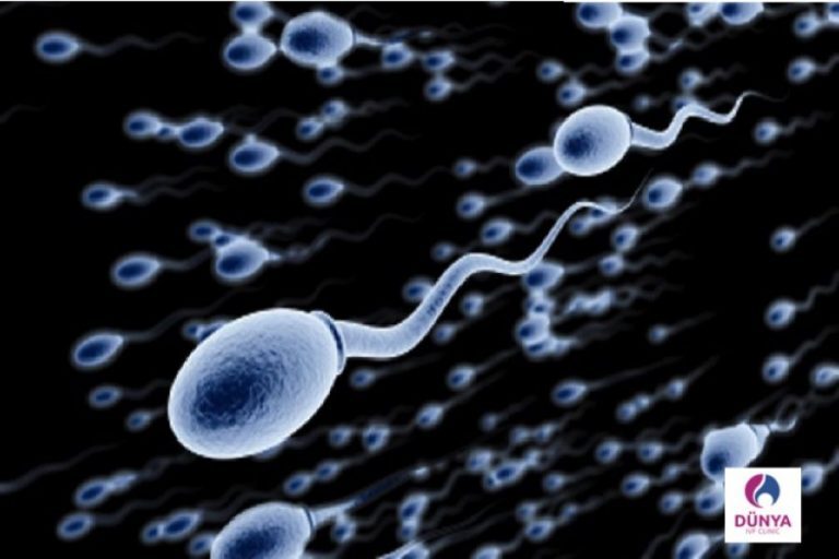 Sperm 768x512